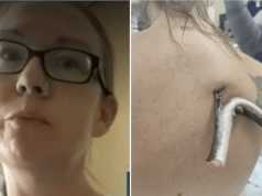 Kristie O'Brien impaled by stingray