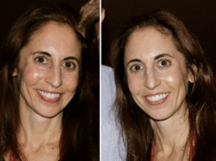 Elizabeth Hirschhorn Airbnb guest eviction of Brentwood squatter