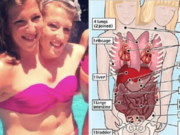 Abby and Brittany Hensel conjoined twins sex life with Josh Bowling