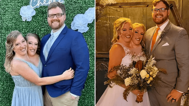 Abby & Brittany Hensel wedding to Josh Bowling as co joined twins plan to become mothers