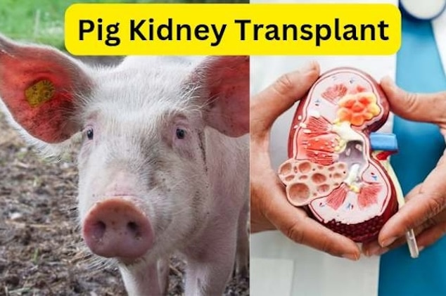 Rick Slayman, patient with world’s first pig kidney transplant goes home after successful organ transplant