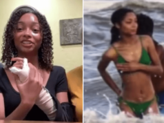 Damiana Humphrey, Oklahoma 19 year old survives Galveston, Texas shark attack