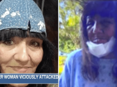 Elsa Davila, Sulphur, Louisiana woman mauled by pit bull mix while giving dog owner money