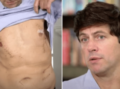Caleb Adams shark attack victim recalls miraculous survival after being bitten multiple times by ocean predator