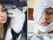 Daniella Abreu, Florida woman loses eye after retractable dog leash accident