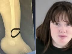 Erin Elizabeth Ann Strotman Henrico Doctors Hospital NICU nurse charged after multiple babies found with unexplained fractures.