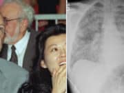 Betsy Arakawa, Gene Hackman wife cause of death revealed as hantavirus pulmonary syndrome with actor dying 1 week later of natural causes.