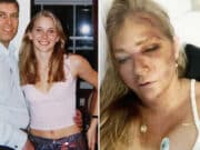 Virginia Giuffre left with 4 days to live after bus crash leaves her with kidney failure according to Instagram post.