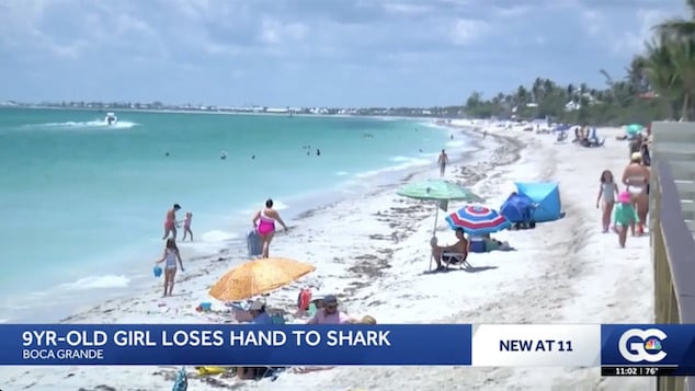 Leah Lendel 9 year old girl survives Florida shark attack after having hand bitten off with emergency surgery re-attaching the severed limb.