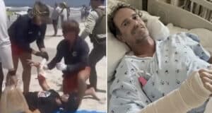 Matt Bender, Winter Park, Florida man survives shark attack at Smyrna Beach after nearly losing his arm and having emergency surgery