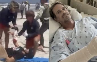 Matt Bender, Winter Park, Florida man survives shark attack at Smyrna Beach after nearly losing his arm and having emergency surgery