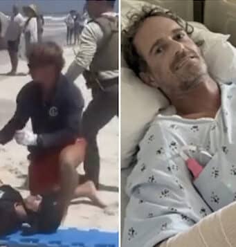 Matt Bender, Winter Park, Florida man survives shark attack at Smyrna Beach after nearly losing his arm and having emergency surgery
