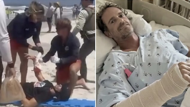 Matt Bender, Winter Park, Florida man survives shark attack at Smyrna Beach after nearly losing his arm and having emergency surgery