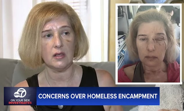 Donna DeChristopher, Los Angeles woman, 52, nearly loses an eye after vicious assault by homeless man in the Los Feliz area