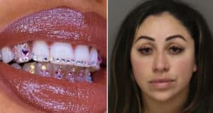 Emely Martinez fake dentist aka 'Itsthe Veneerlady' arrested after performing cosmetic dental work on unwitting patients