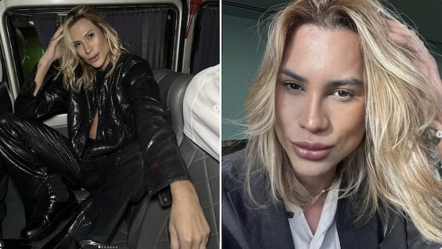 Junior Dutra Brazilian fashion influencer dies following complications from fox eyes cosmetic surgery.