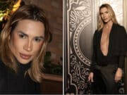 Junior Dutra Brazilian fashion influencer dies following complications from fox eyes cosmetic surgery.