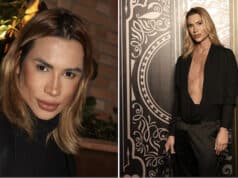 Junior Dutra Brazilian fashion influencer dies following complications from fox eyes cosmetic surgery.