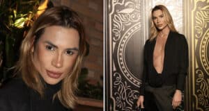 Junior Dutra Brazilian fashion influencer dies following complications from fox eyes cosmetic surgery.
