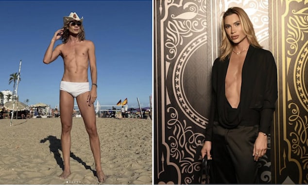 Brazilian fashion influencer and instagram star dies following complications from fox eyes cosmetic surgery.