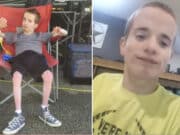 Jonathan Kinman, Burleson special needs son buried in Texas parents back yard as cause of death is pending.