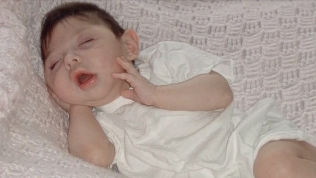 Woman born with no brain turns 20 in medical ‘miracle’ — told she’d never make it to 5.