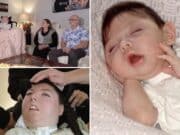 Alex Simpson, Omaha, Nebraska woman born with no brain makes it to 20 years old as family credit love and faith for beating the odds.