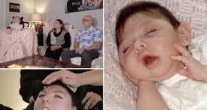 Alex Simpson, Omaha, Nebraska woman born with no brain makes it to 20 years old as family credit love and faith for beating the odds.