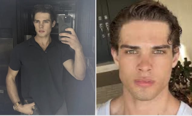 Clavicular hospitalized after overdose in latest troubling antics of controversial Looksmaxxing influencer with large incel following.