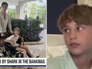 Parker Roll, Friendswood, Texas 12-year-old boy survives Bahamas shark attack.