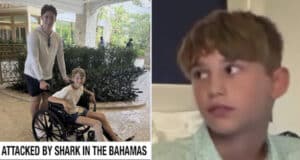 Parker Roll, Friendswood, Texas 12-year-old boy survives Bahamas shark attack.