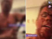 Perez Hilton self harm TikTok livestream video during mental health crises